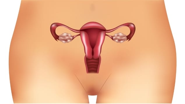quistos ou cistos no ovarios tipos e sintomas