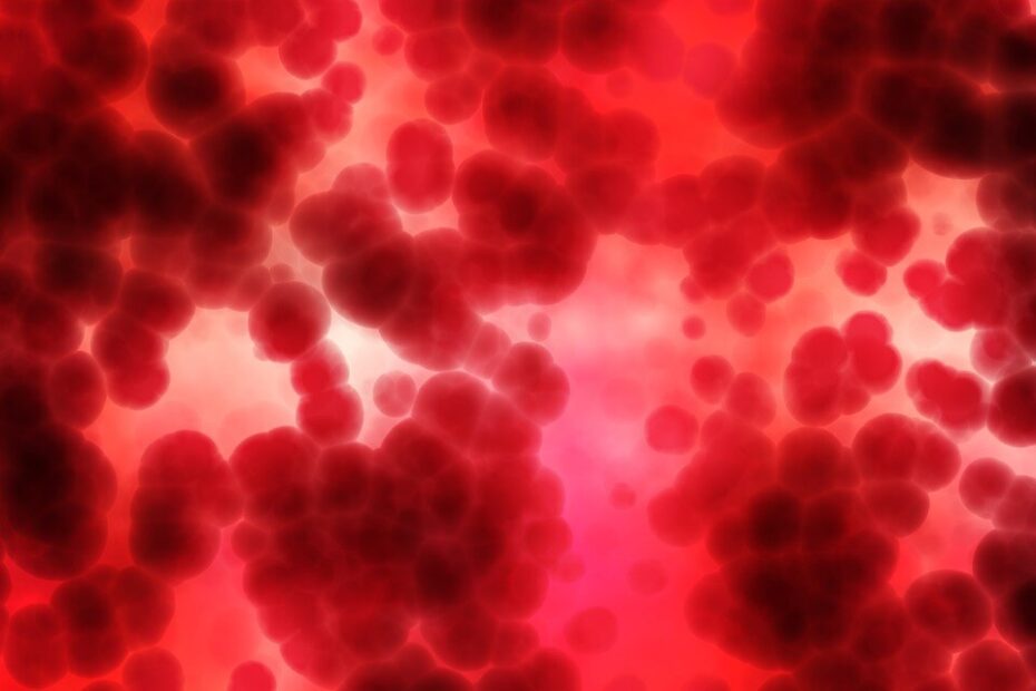 A anemia e alimentação em Alimentação A anemia e alimentação