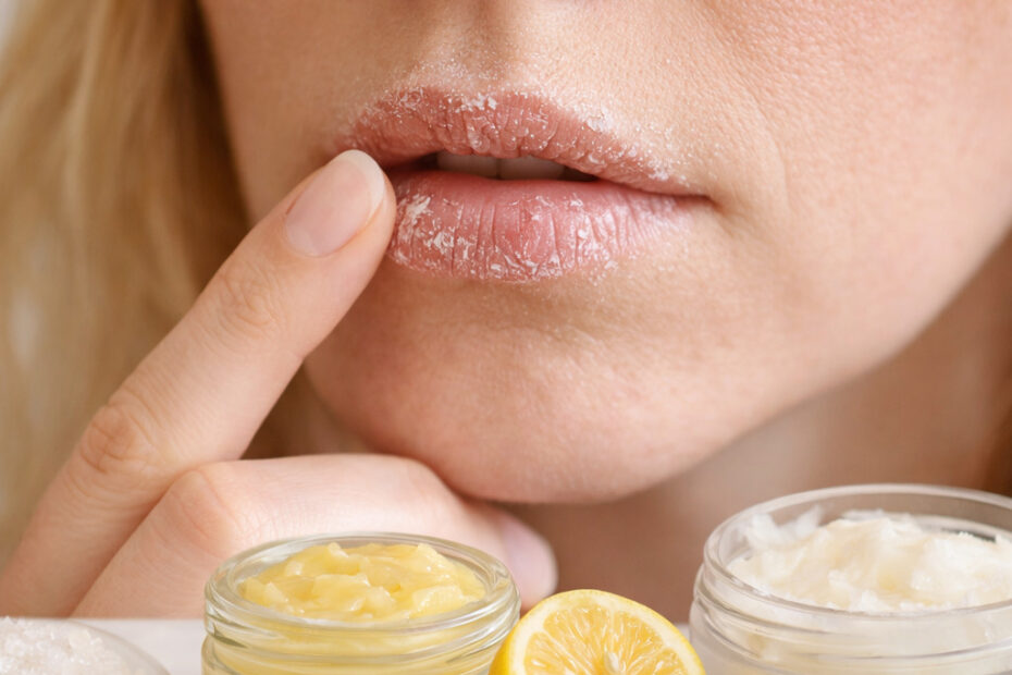 Lábios Ressecados: Esfoliante Exclusivo para Hidratação